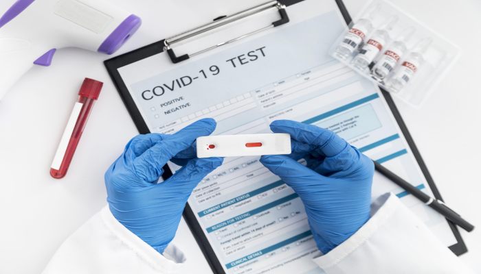 Rapid Test Antibodi, Rapid Test Antigen atau Swab Antigen, dan PCR. Apa Bedanya?
